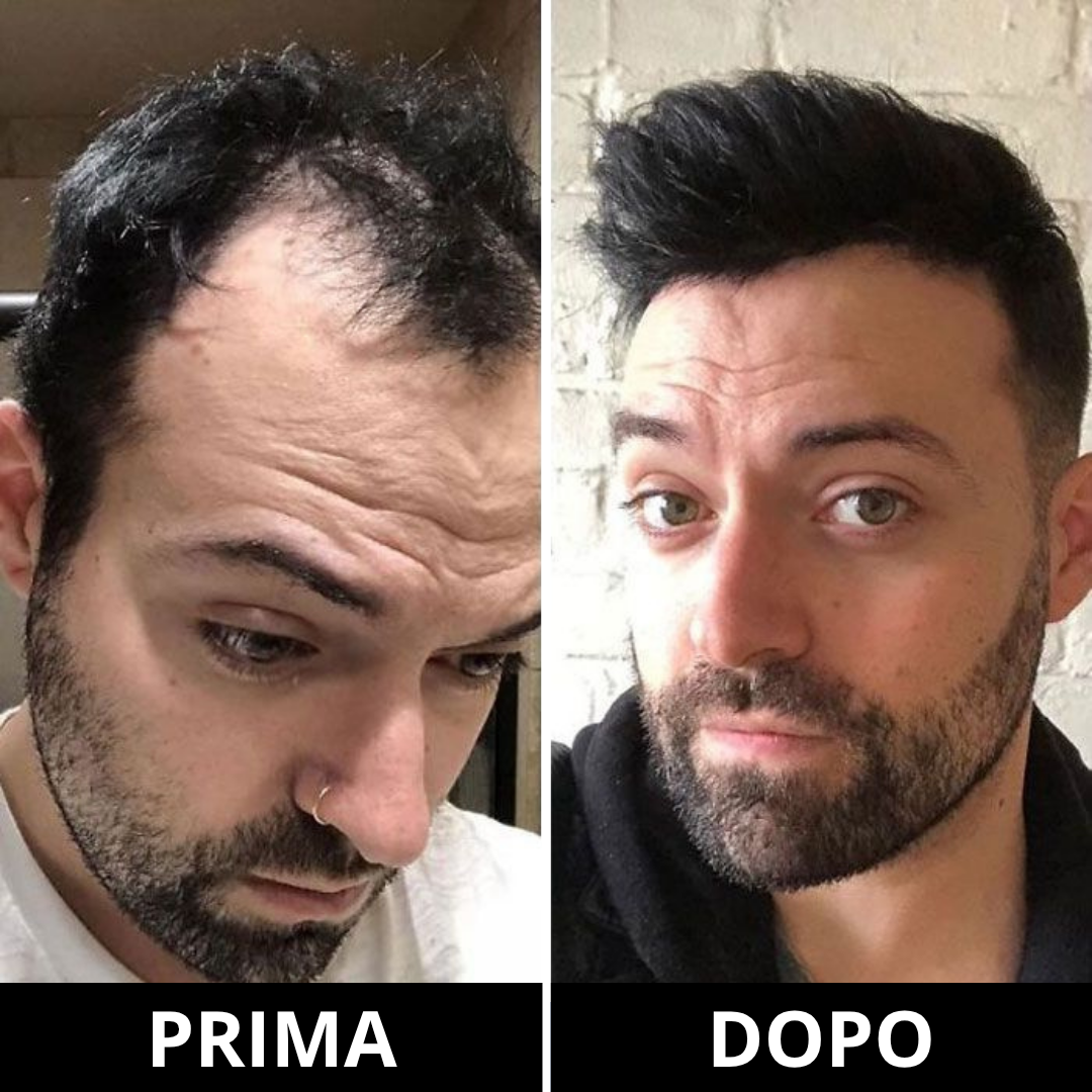 Depura - Siero Roll-on Rigenerante per capelli