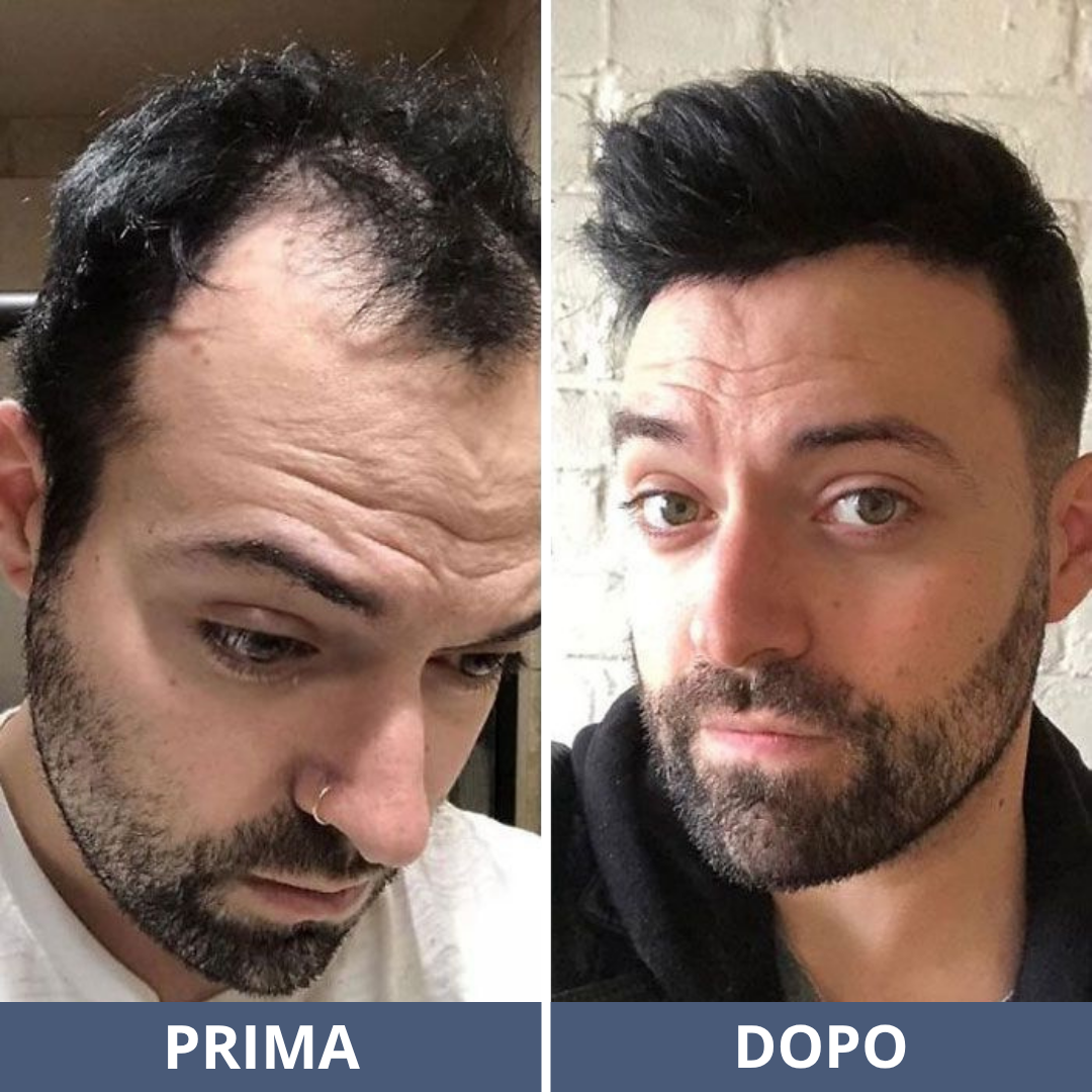 Siero Rigenerante per Capelli
